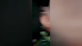 Nyc vú trắng